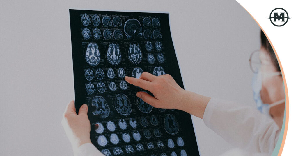 How Common Are Traumatic Brain Injuries After a Car Accident?